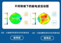 睡眠仪什么牌子好？即眠睡眠仪让你快速进入梦乡！